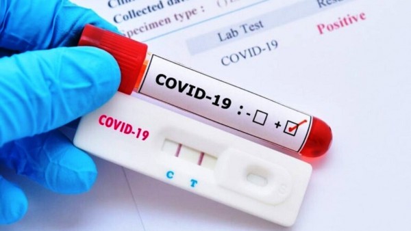 ΔΗΜΟΣ ΧΑΛΚΙΔΕΩΝ: Πού θα γίνουν rapid test αυτή την εβδομάδα
