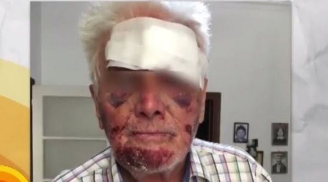 Χαράκωσαν ηλικιωμένο για πέντε ευρώ