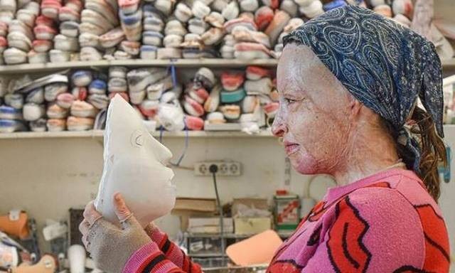 ΙΩΑΝΝΑ ΠΑΛΙΟΣΠΥΡΟΥ-ΕΠΙΘΕΣΗ ΜΕ ΒΙΤΡΙΟΛΗ: Πέταξε τη μάσκα και συγκλονίζει...