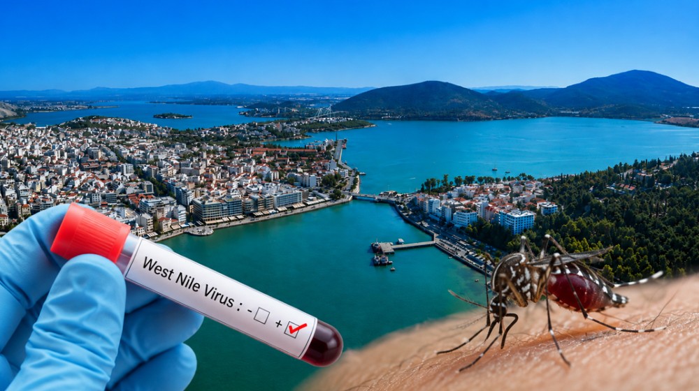 ΧΑΛΚΙΔΑ: Πρώτο κρούσμα του ιού του Δυτικού Νείλου