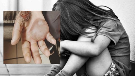 Σοκ: Πατέρας κακοποιούσε σεξουαλικά και έκαιγε το παιδί του όταν αντιστεκόταν