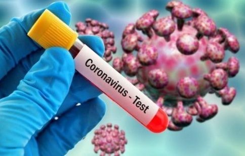 ΚΟΡΩΝΟΪΟΣ: Πάνω από 1150 τα κρούσματα την Πέμπτη και 78 νεκροί