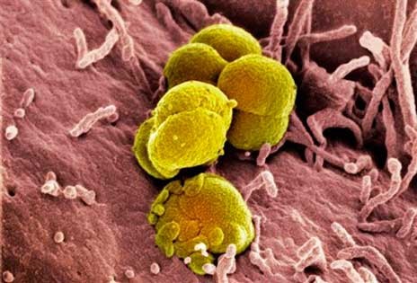 Προειδοποίηση από τον Παγκόσμια Οργανισμό Υγείας: Εξαπλώνεται η βλεννόρροια
