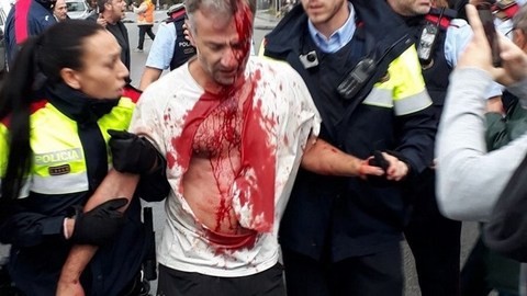 Χύθηκε αίμα για το δημοψήφισμα στην Καταλονία
