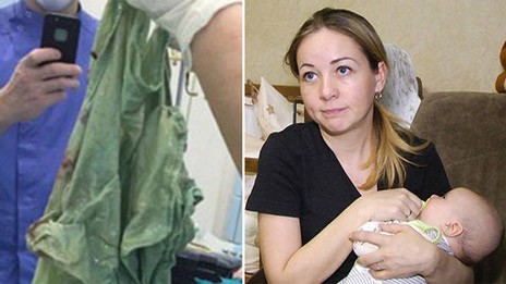 Ξέχασαν σεντόνι στην κοιλιά της μητέρας, μετά από την καισαρική