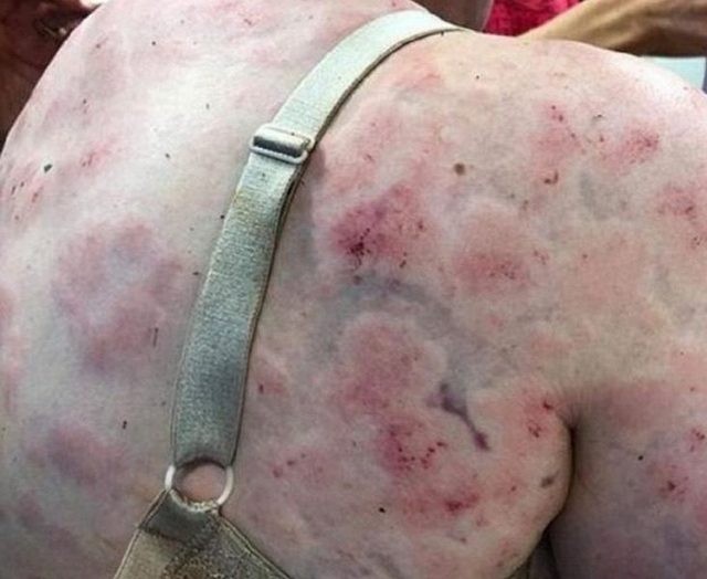Ηρωίδα μάνα έσωσε το μωρό της απο χαλάζι