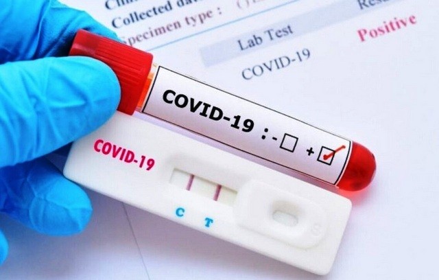 Πόσα rapid test βγήκαν θετικά τη Δευτέρα στη Χαλκίδα