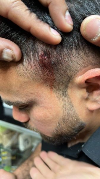 ΑΘΗΝΑ: Οδηγός ταξί πυροβόλησε 26χρονο μετανάστη στο κεφάλι