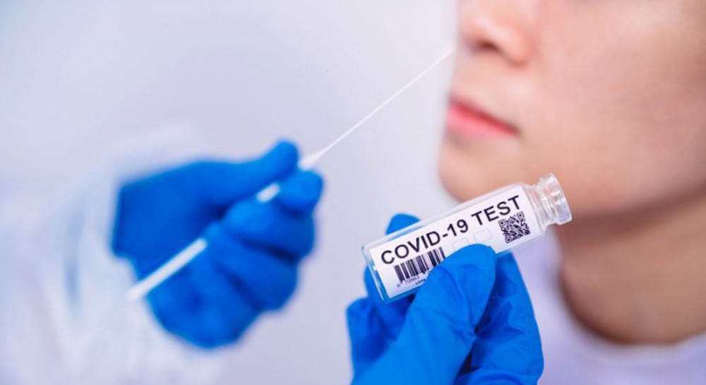 ΔΗΜΟΣ ΧΑΛΚΙΔΕΩΝ: Δωρεάν rapid test σε Χαλκίδα και Αρτάκη όλη την εβδομάδα